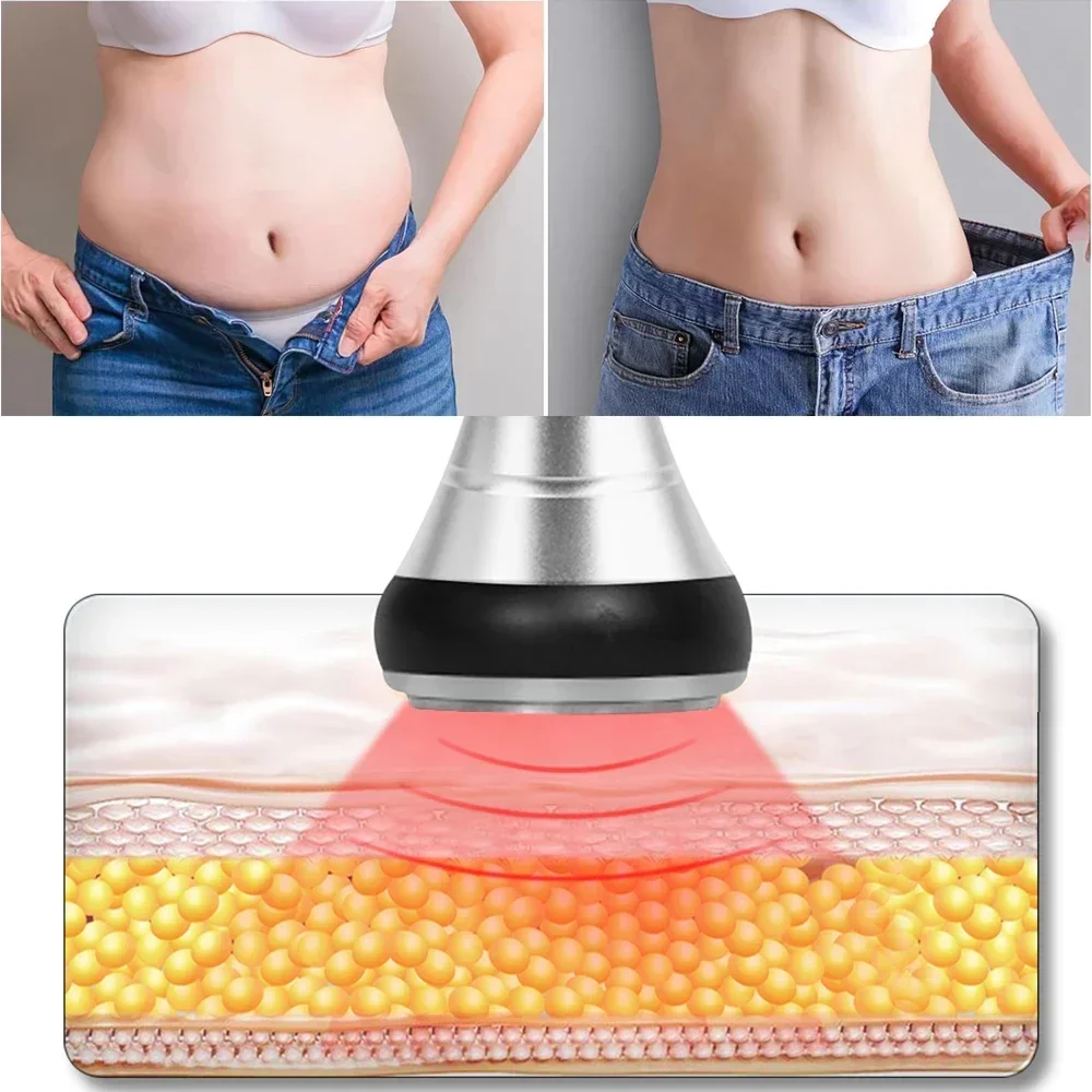 Mesin Kavitas 4-in-1 40K Ultra - Spa Y Wellness ulasan dan harga